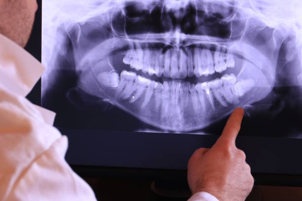 Best Emergency Dental Care for Sports Injuries in Glen Dale, WV