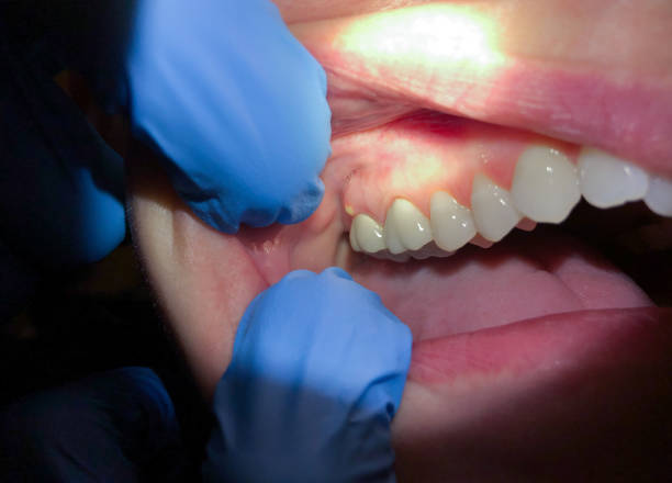 Best Walk-In Emergency Dental Services in Glen Dale, WV
